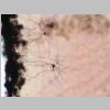 Neuronas Golgi 35.jpg